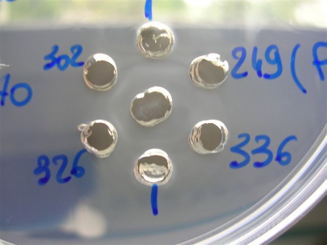 Immunodiffusion en gélose.jpg